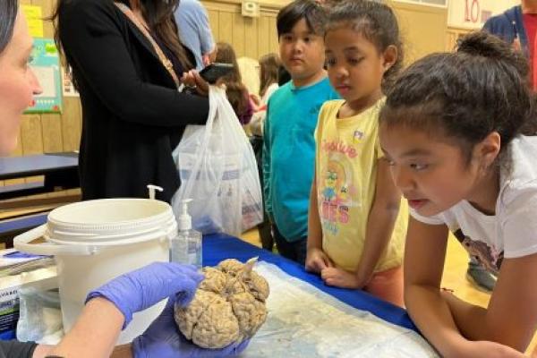 A group of children huddle around a woman pointing to a disembodied human brain.