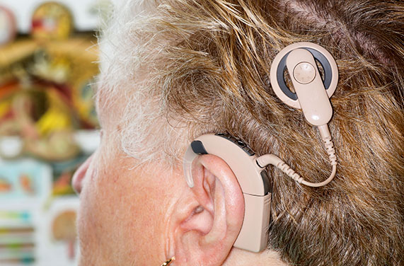 Patient wearing a cochlear implant