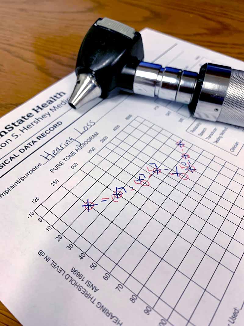 An otoscope is laying on top of a form used to record audiogram test results.