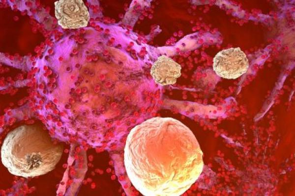 A 3D model of cancer cells being attacked by the immune system cells found in the body.