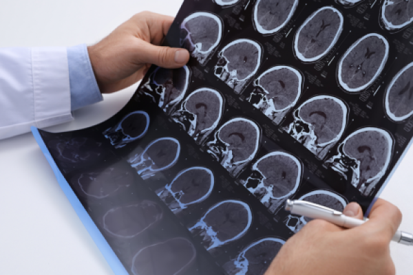 Black and white images from brain CT scan